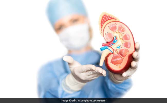 5 Dietary Habits That Can Prevent Kidney Stones Forever