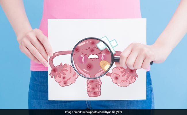International Women's Day 2024: What Every Woman Should Know About Pap Smears