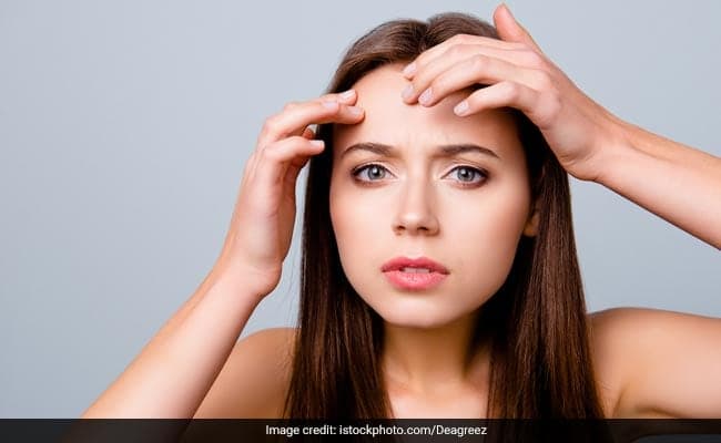Bangs Can Cause Forehead Acne, Says Dermatologist Dr. Jaishree Sharad
