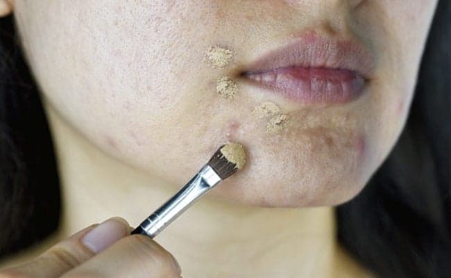 Follow These Tips To Keep Acne And Breakouts At Bay