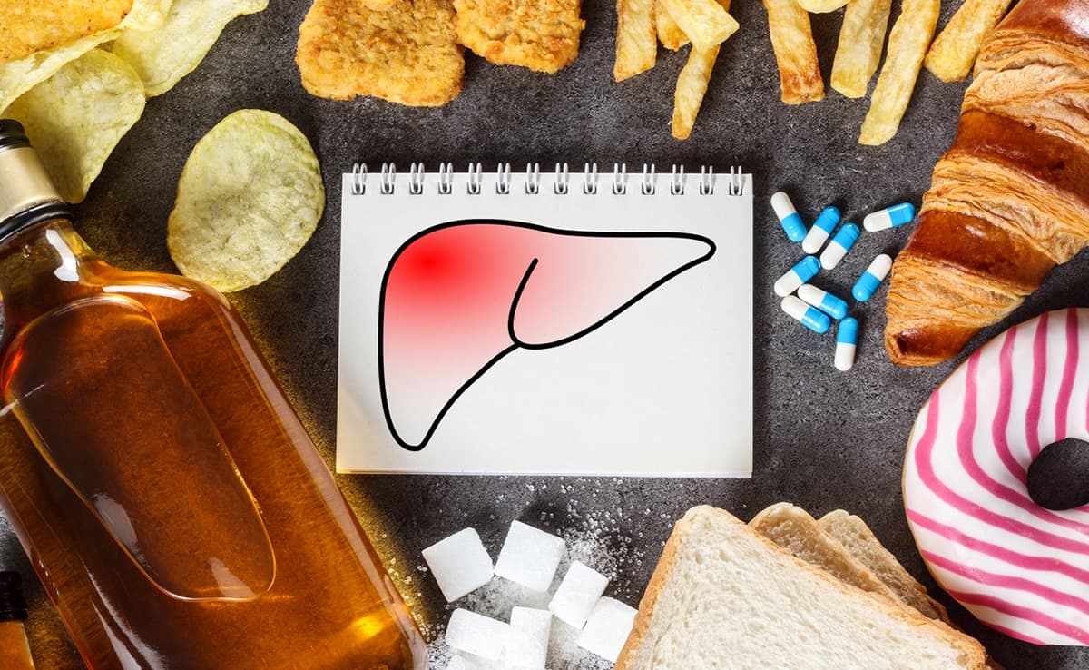 Best And Worst Foods For Fatty Liver Disease