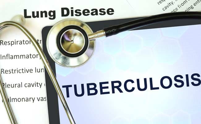 World Tuberculosis Day 2024: Minimise close contact with individuals diagnosed with TB
