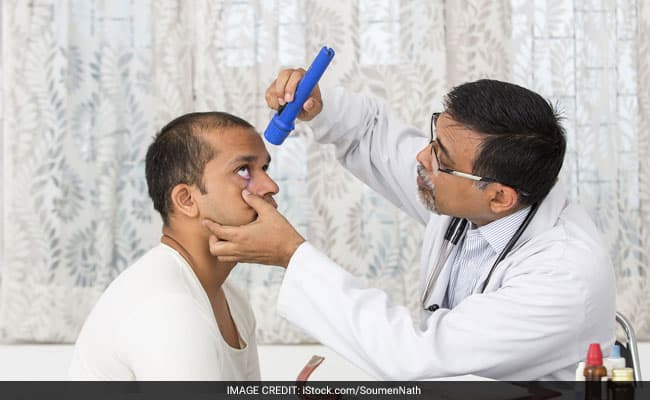 The only sure way to diagnose glaucoma is with acomplete eye exam