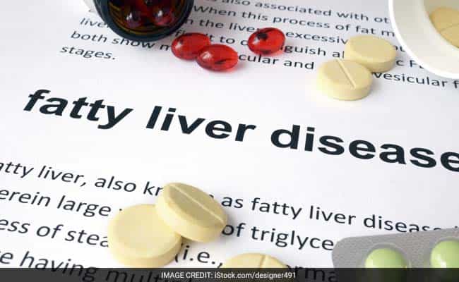 When over 5-10% of the liver's weight is fat, it means you are suffering from fatty liver