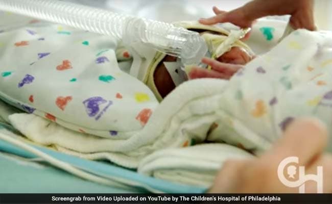 Preterm birth risk spikes after a woman turns 40!