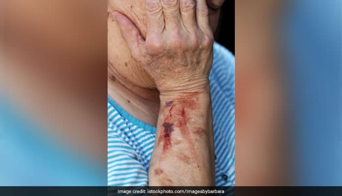 Its important to develop guidance to effectively prevent and respond to elder abuse