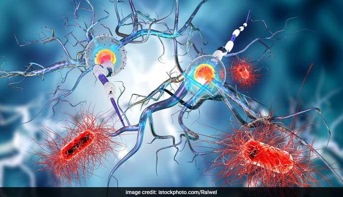 Parkinson's primarily affects neurons in an area of the brain called the substantia nigra.
