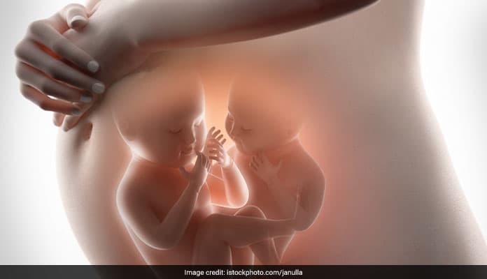 Twin pregnancy: According to the March of Dimes, close to 60 percent of all twins are born prematurely