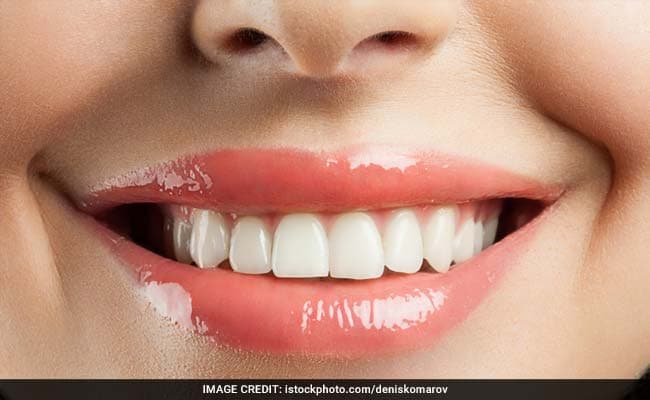 World Oral Health Day 2018: Brushing twice a day and flossing helps improve your yellow teeth