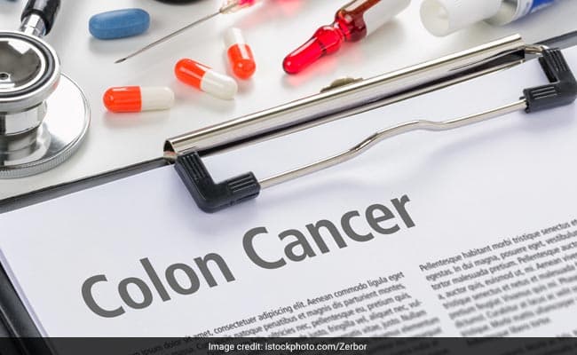 Colon cancer risk can be reduced by quitting smoking and reducing alcohol consumption