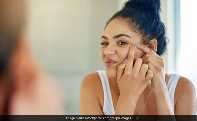 If there is one universal skin problem that we all can relate to, it is acne.