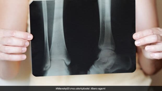 Calcium and vitamin D are essential for bone health