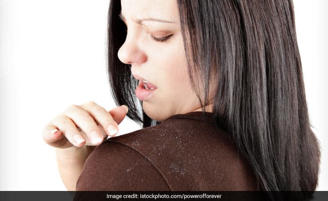 Nutritional deficiency can cause scalp issues in the body