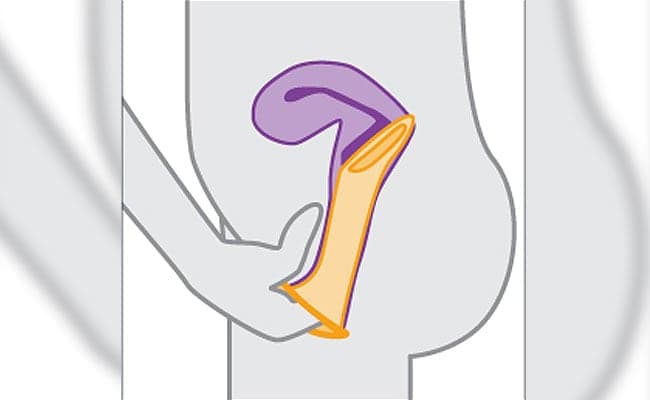 Female condoms can be worn hours before the sexual activity