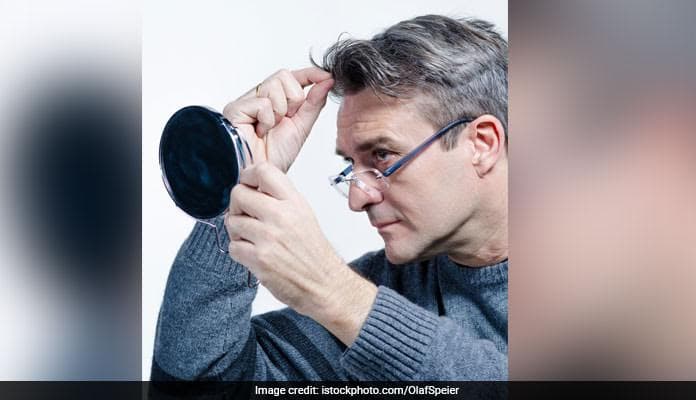 Research says that baldness and greying before 40 means that your body is ageing faster
