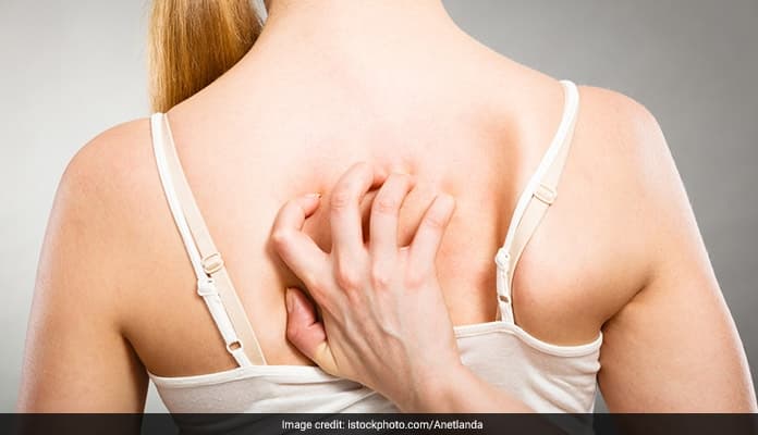 7 Effective Ways To Get Rid Of Acne On The Back