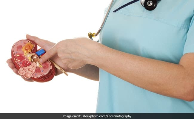 Kidney Stones: 5 Best Ayurvedic Cures To Get Rid Of Stones