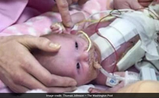 Newborn was diagnosed with a rare medical condition