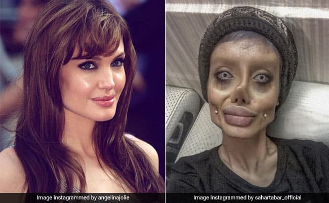 Sahar Tabar underwent 50 surgeries to look like Angelina Jolie
