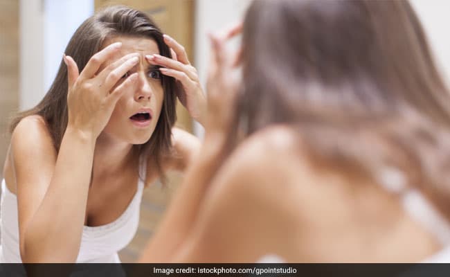 Acne can increase your risk of depression