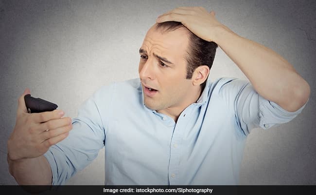 PRP therapy garners hair growth beyond the natural growth of hair