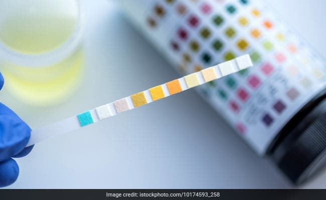 This new marker provides a method to measure how much our body has aged