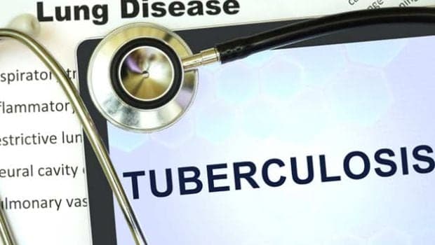 TB bacterium hijacks platelets from the body's blood clotting system can weaken immune systems.
