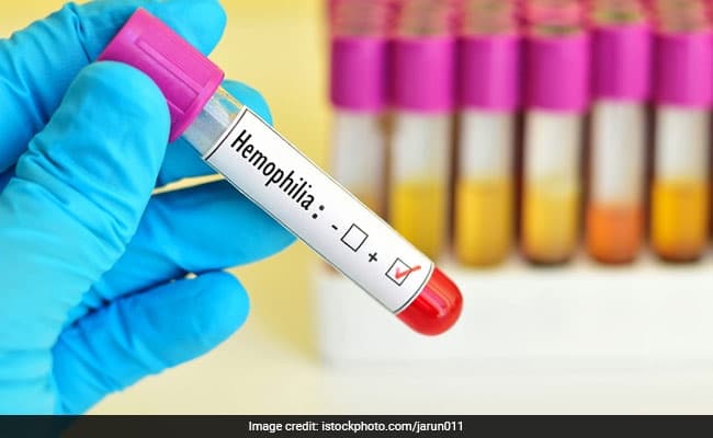 World Hemophilia Day 2018: April 17 is observed as World Hemophilia Day