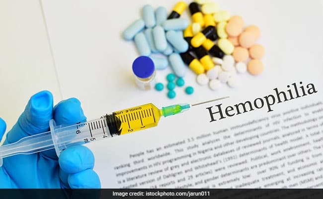 World Hemophilia Day: Hemophilia is a bleeding disorder which slows down blood clotting