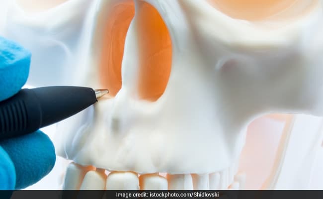 Deviated septum or deviated nasal septum is a structural disorder of the nose