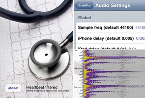 iPhone app to replace the stethoscope?